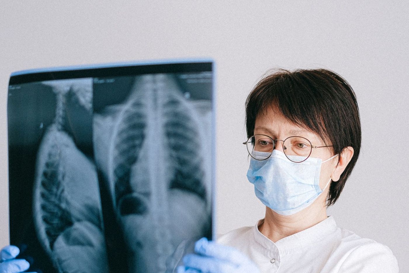A doctor reviewing an X-ray